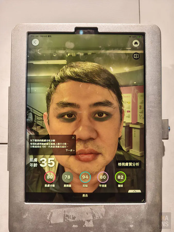 翰斯的肌膚檢測結果出爐